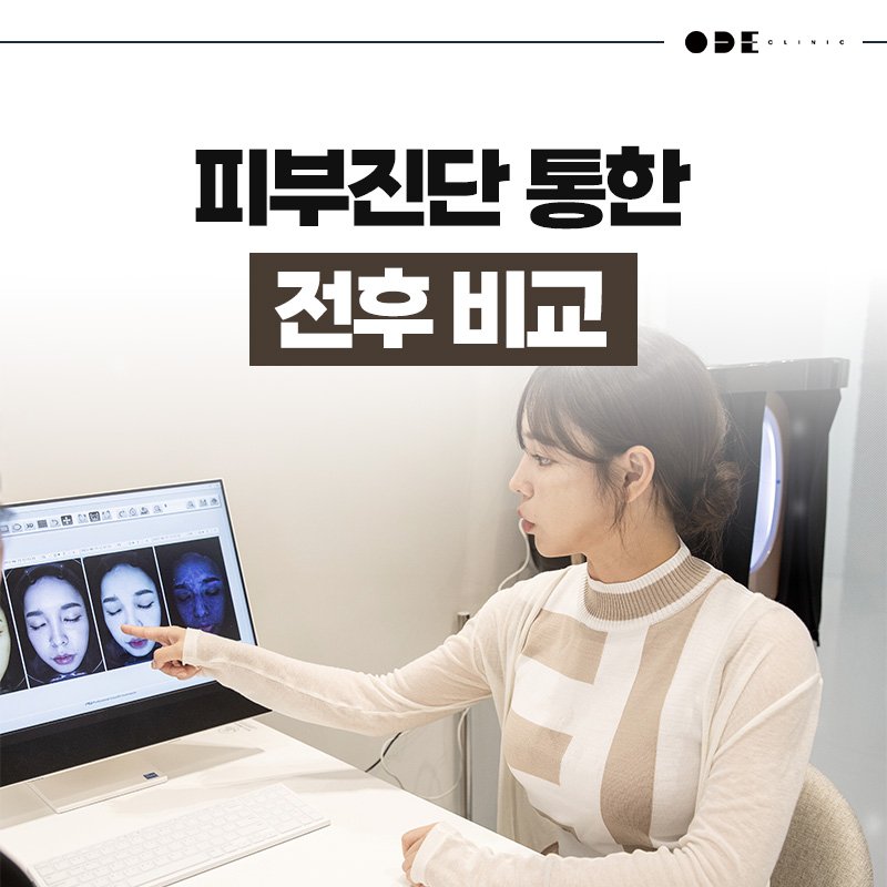 1:1 진단