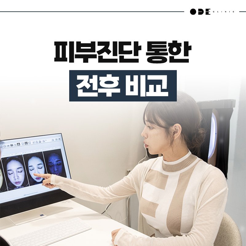 얼굴형 분석